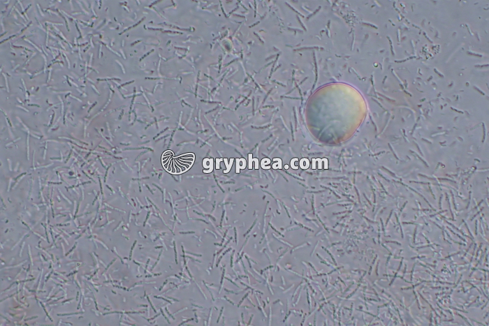 Mycobactéries x200 - gryphea.com